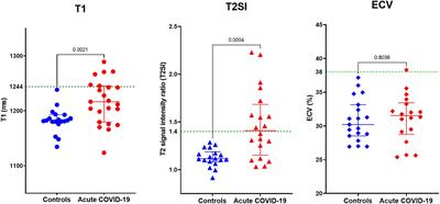 Acute changes in myocardial tissue characteristics during hospitalization in patients with COVID-19